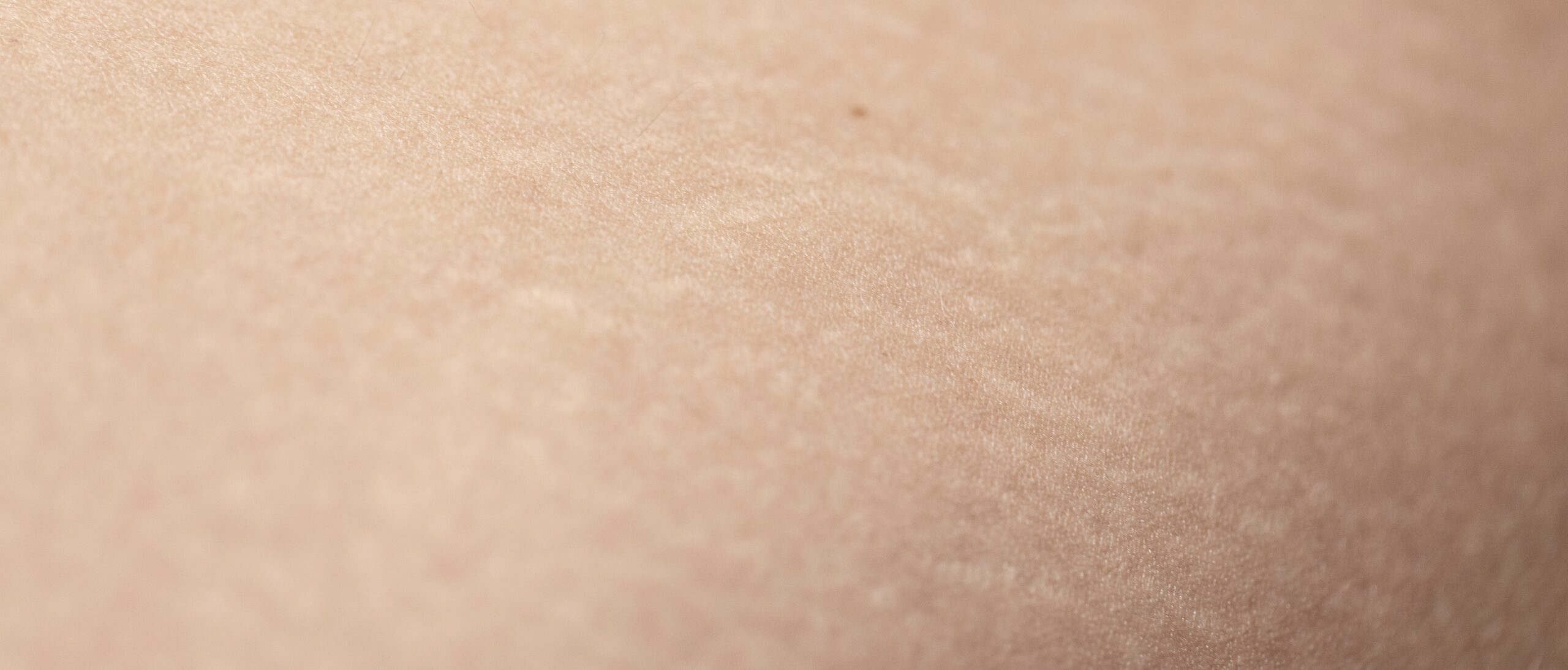STRIAE